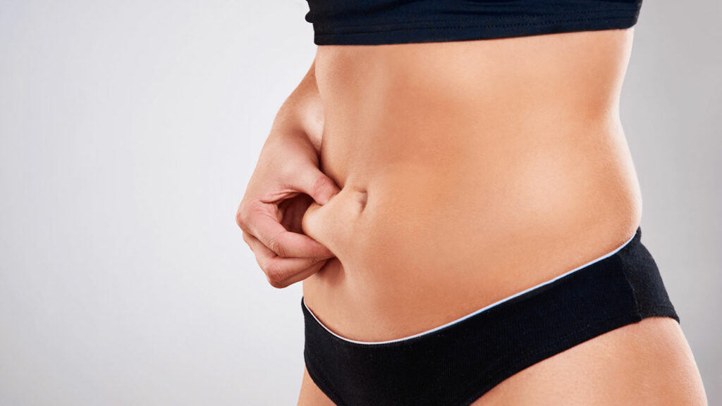 Abdominoplastia: o que é e como é feita?